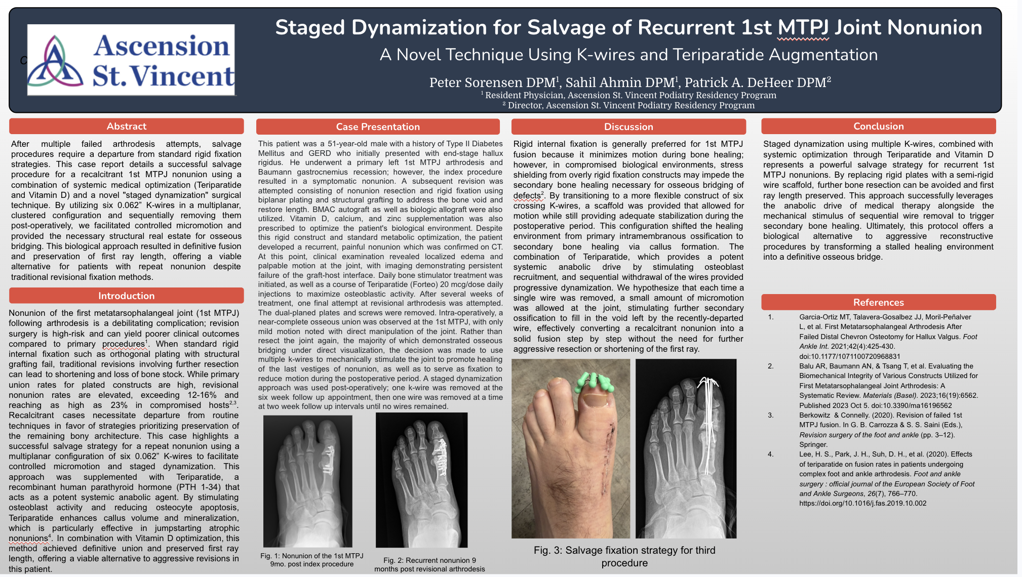 Conference poster: Staged Dynamization for Salvage of Recurrent 1st MTPJ Joint Nonunion, presented at APMA The National 2026